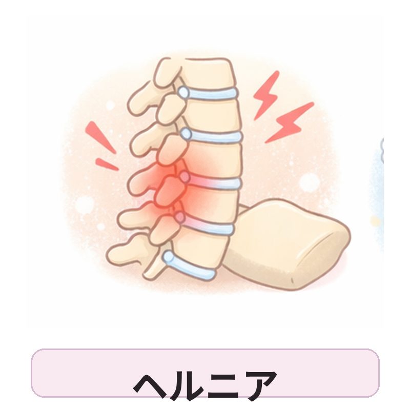 ヘルニアで眠れない